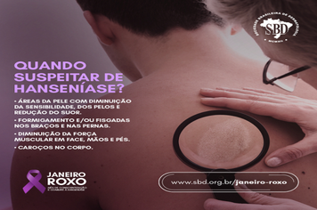 Hanseníase tem cura e o tratamento é gratuito e ofertado pelo SUS