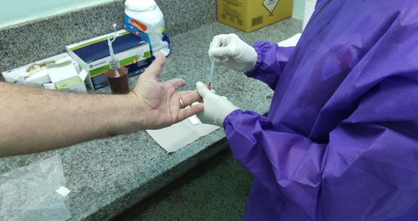 Covid-19: Pirapora recebe testes rápidos para equipes de linha de frente