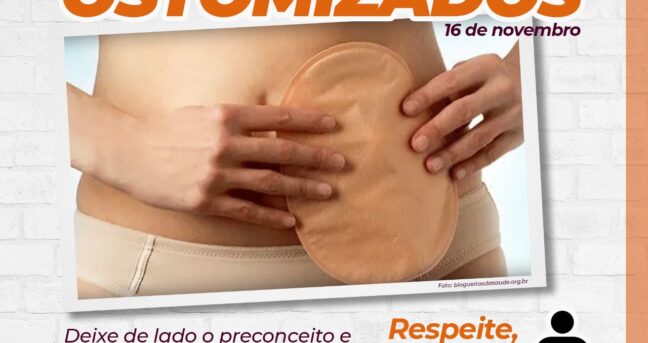 Dia Nacional dos Ostomizados e o combate ao preconceito